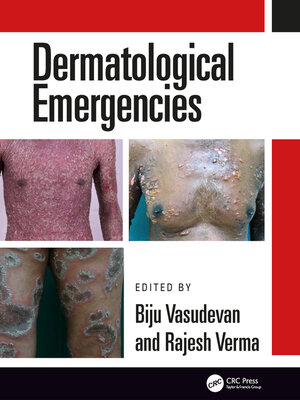 cover image of Dermatological Emergencies